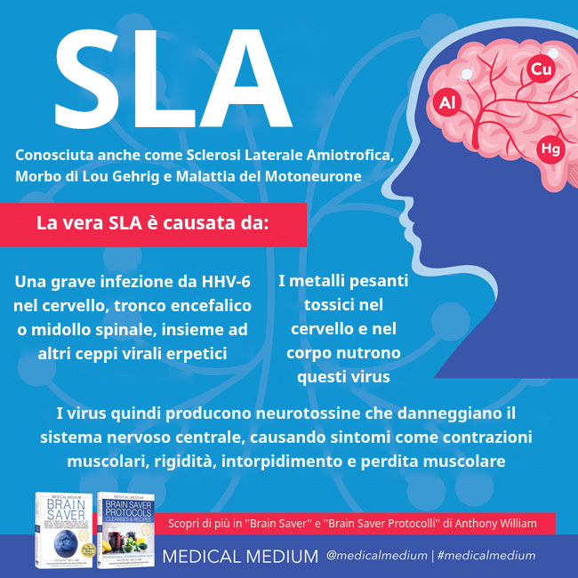 SLA