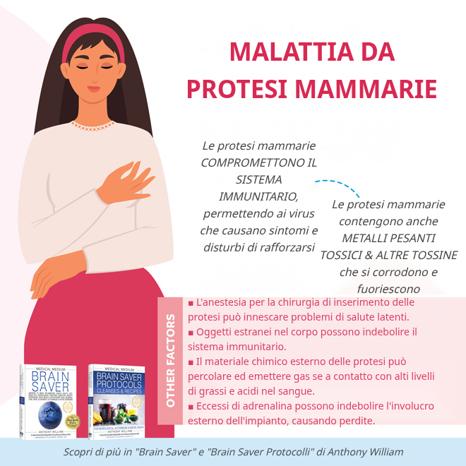 Malattia da Impianti al Seno