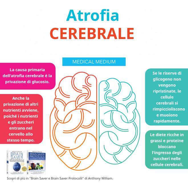 Atrofia Cerebrale