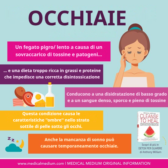 Occhiaie Scure