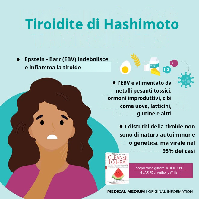 Tiroidite di Hashimoto