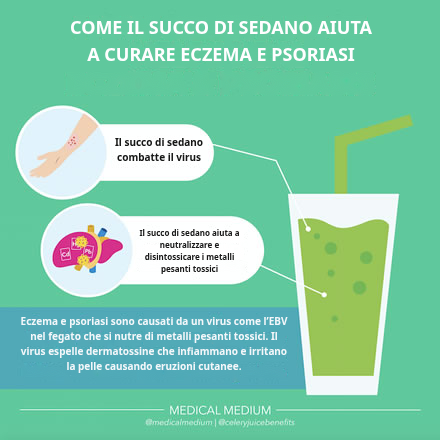 Come il succo di sedano aiuta a guarire eczema e psoriasi
