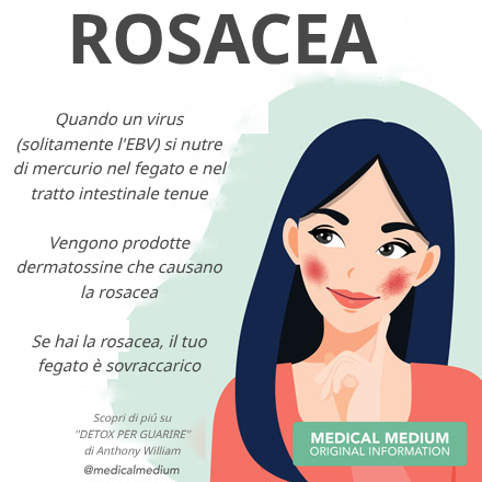 Rosacea