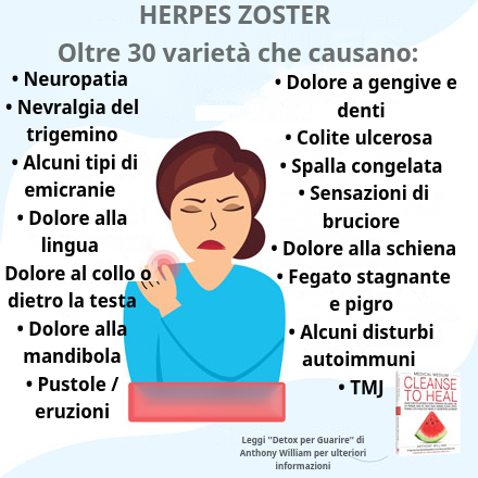 Herpes Zoster