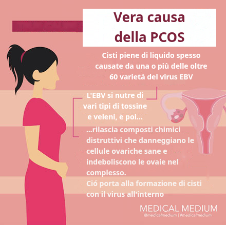 Vera Causa della PCOS