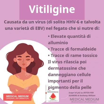 Vitiligine